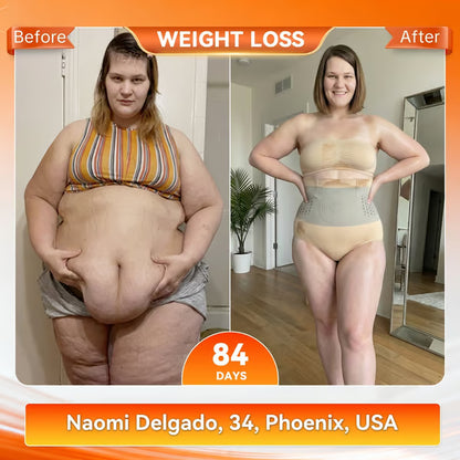 🛡️2026 Moringa & Berberine 4-in-1 Micro-Particle Shaping & Fat Burning Shorts