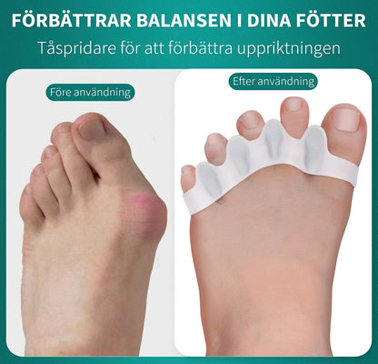 🦶 Magic tåspridare & hallux valgus-skydd – Omedelbar smärtlindring vid hallux valgus, överlappande tår & knölar | Dam & Herr ✨