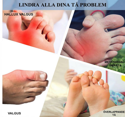 🦶 Magic tåspridare & hallux valgus-skydd – Omedelbar smärtlindring vid hallux valgus, överlappande tår & knölar | Dam & Herr ✨